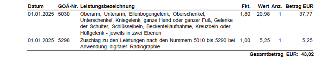 Beispielrechnung zur Veranschaulichung von Zuschlag 5298
